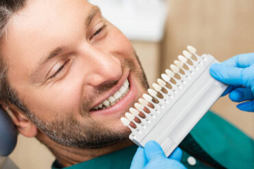 When Is It Time To Change Your Veneers?